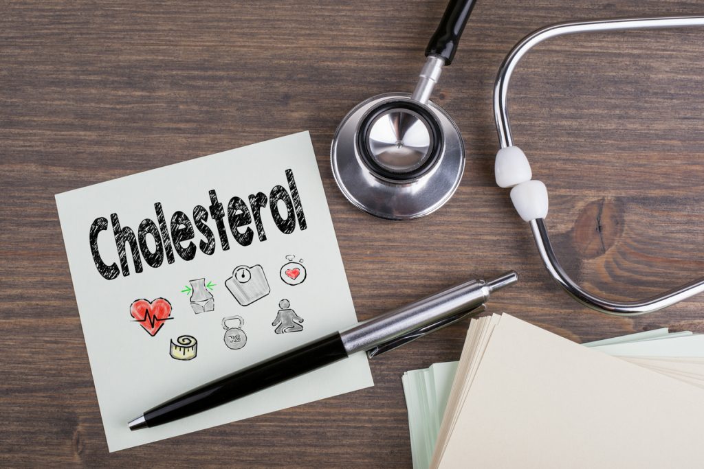 Medical tests for cholesterol can be done at home.